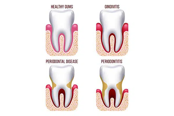 teeth structure