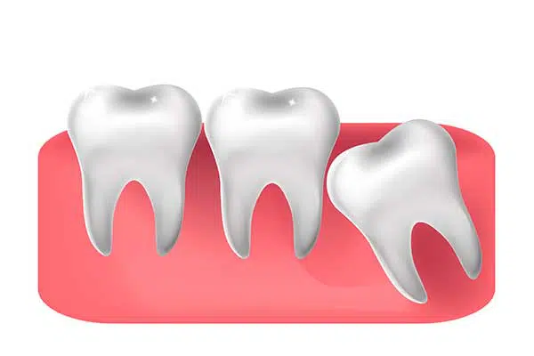 Dental assistance
