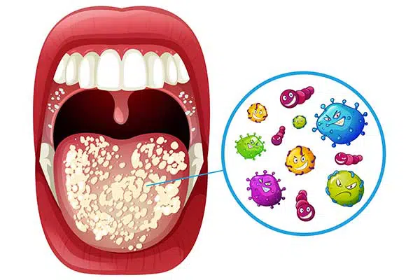 Teeth Cleaniness