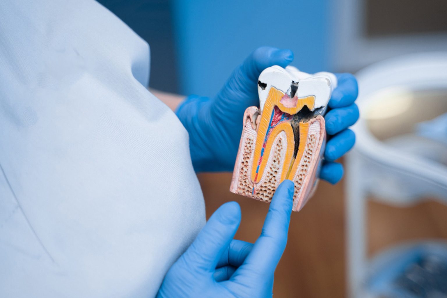 Read more about the article What to Expect After a Root Canal: Care and Recovery Tips