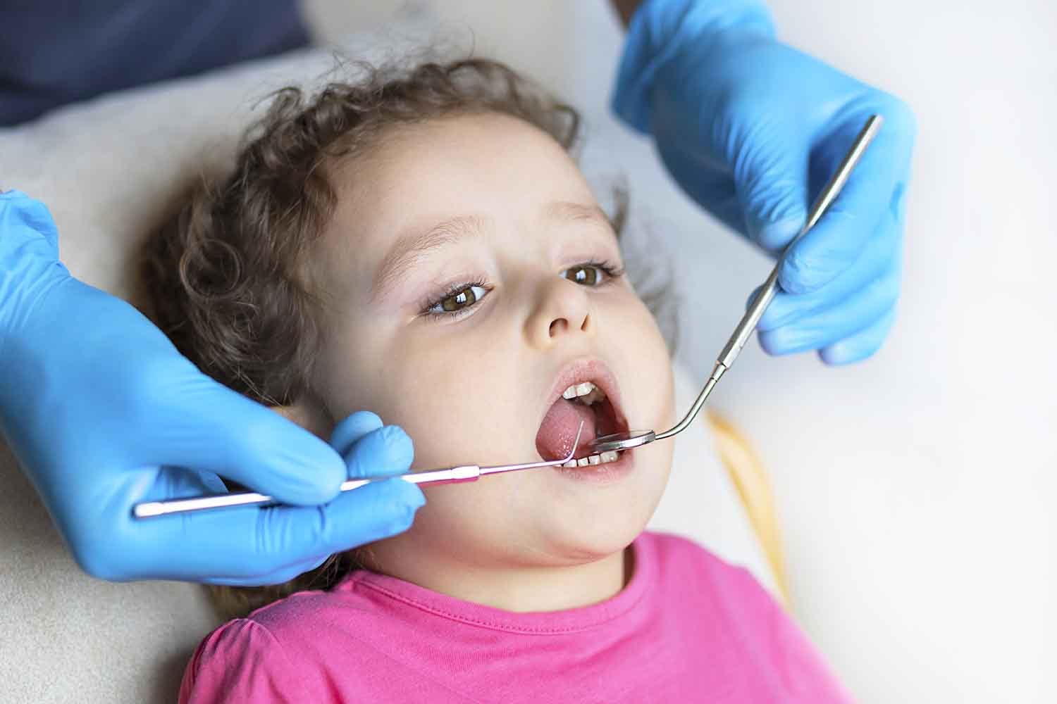 You are currently viewing Why Do Kids Get Cavities Even After Brushing?