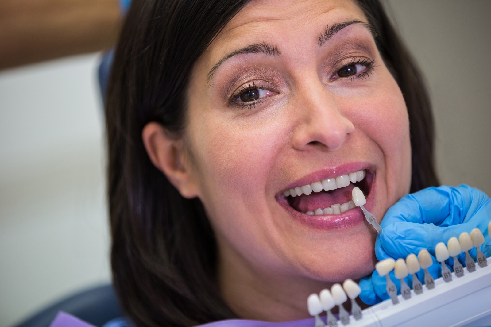 You are currently viewing Why Dentists Use Ceramic Veneers for Smile Design