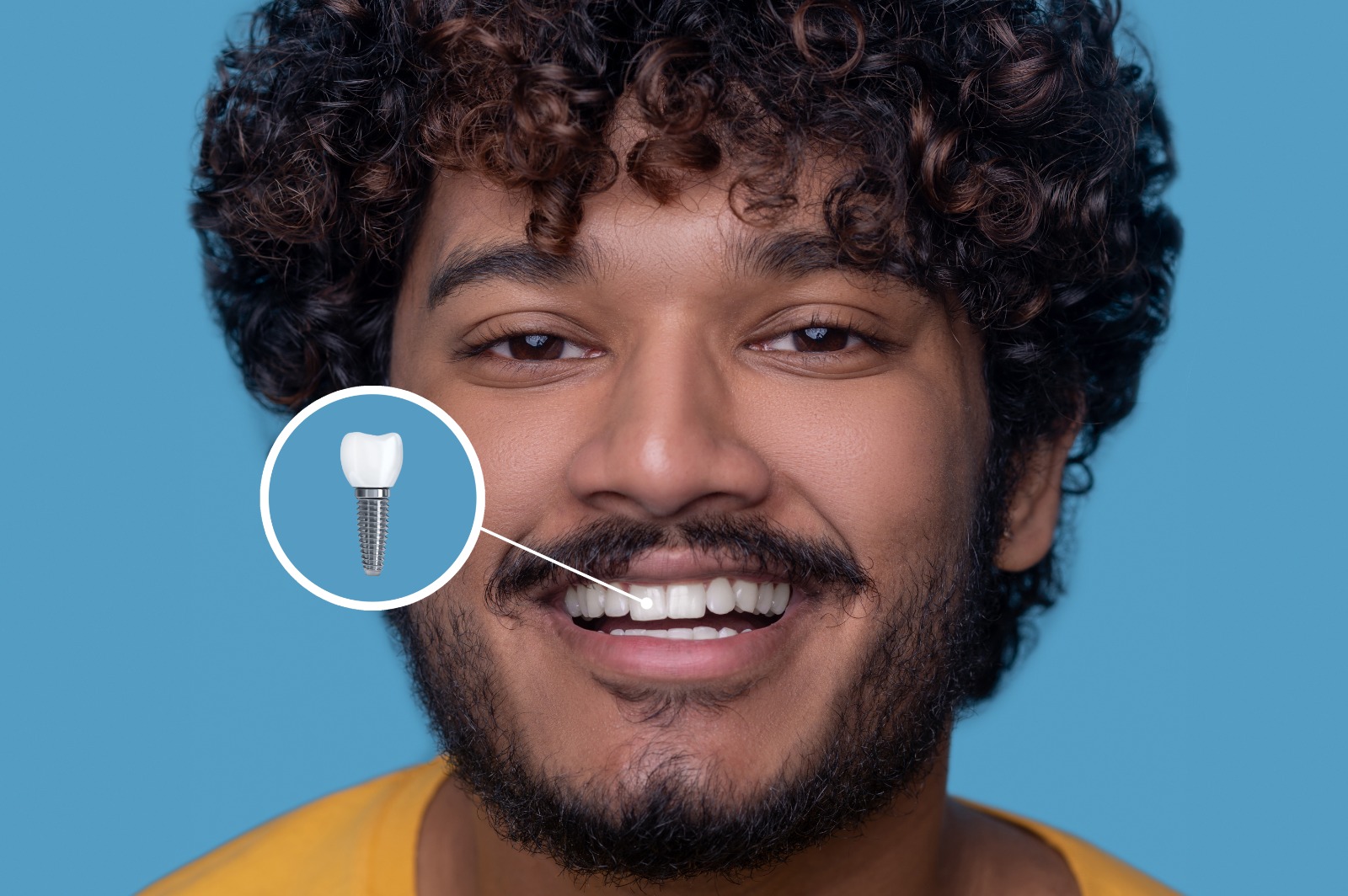 You are currently viewing Dental Implant Cost in Vizag 2026: What You Should Expect to Pay
